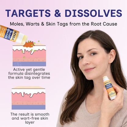 🌟 Official Store | 🛡️ The 'Glue Stick' Secret to Clear Skin! RZXEA™ Solid-Stick Wart Remover