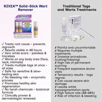 🌟 Official Store | 🛡️ The 'Glue Stick' Secret to Clear Skin! RZXEA™ Solid-Stick Wart Remover