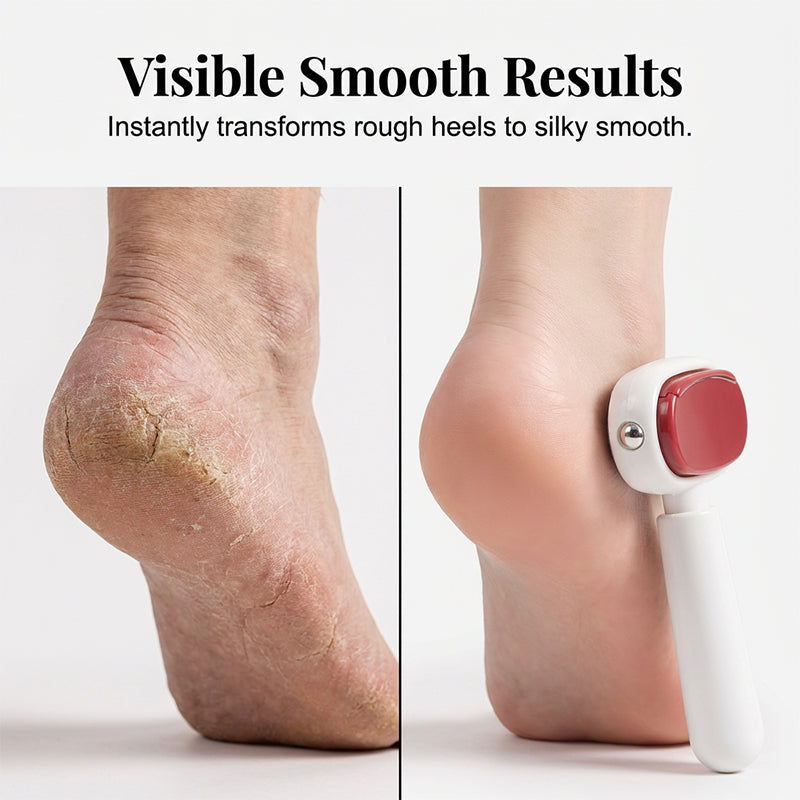 ⚡⚡⚡LAST 44 PCS LEFT!!! ⏰🔥 LAST DAY SALE 50% OFF 🏆 Double-Sided Foot Scraper – Easily Removes Calluses and Dead Skin ✨🦶